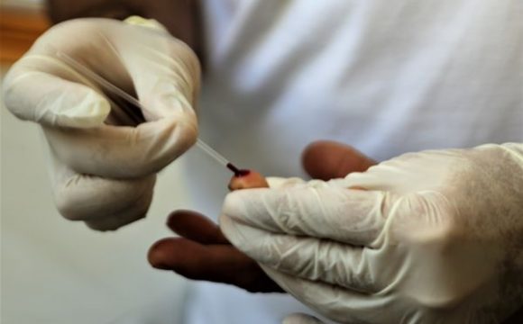 Semana de combate à Sífilis alerta sobre fases da doença